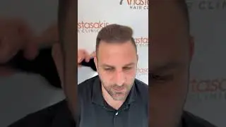 🔥 &Alpha;&gamma;&nu;ώ&rho;&iota;&sigma;&tau;&omicron;&sigmaf; &sigma;&epsilon; 18 &mu;ή&nu;&epsilon;&sigmaf;! &Alpha;&pi;ό &Sigma;&tau;ά&delta;&iota;&omicron; 6 &sigma;&epsilon; &Pi;&lambda;ή&rho;&epsilon;&sigmaf; &Mu;&alpha;&lambda;&lambda;ί &mu;&epsilon; 3.500 &tau;&rho;&iota;&chi;&omicron;&theta;&upsilon;&lambda;ά&kappa;&iota;&alpha;! 💇&zwj;♂️✨ | case #370b