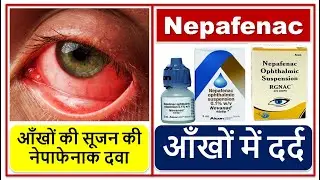 आँखों में दर्द की दवा, आँखों की सूजन की दवा, नेपाफेनाक, Eye pain & Inflammation  Medicine Nepafenac