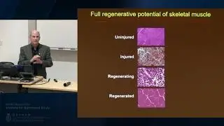 IAS Distinguished Lecture: Prof Thomas Rando (Jan 4, 2018)