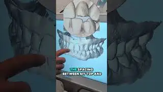 Dr. John Shepherd has an Invisalign update! 🦷✨