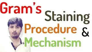 Gram stain | Principle| Mechanism