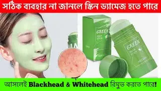 Viral Green Mask Stick | Does it Remove Blackhead or Does it Damage Skin ❗️Honest Review