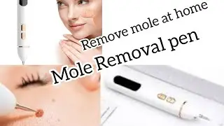 mole removel pen | remove tattoo at home | honest review | How to use mole removel pen