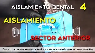 AISLAMIENTO ABSOLUTO DEL FRENTE ANTERIOR para odontolog&iacute;a restauradora, endodoncia y est&eacute;tica dental