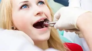 Emergency Dentist Chicago - Urgent Dental Care - Knocked Out Tooth