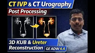 Ct ivp ct urography postporsising in GE ADW 4.4 #ivp #urography