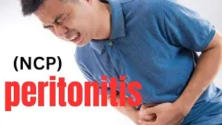 Nursing care plan (NCP) on peritonitis