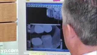 Encinitas Dentist - Dr. James A Snow DDS - (760) 436-7222