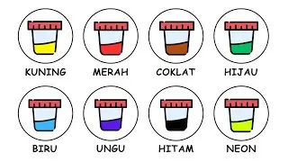 Semua Warna Pipis Dijelaskan Dalam 8 Menit !