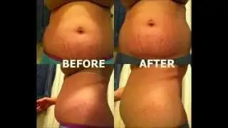 It Works Body Wraps: A SCAM or Does It Work? It Works Body Wrap Before & After photos