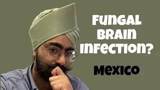 Unraveling the Terrifying Reality: Fungal Brain Infection Spreading Rapidly