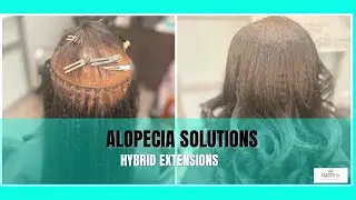 Alopecia Hairstyles & Solutions: Seamless I-Tips and Braidless Sew-In Transformation