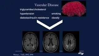 &ldquo;Healthy Brain Aging&rdquo; by Kaitlin Casaletto, PhD, at MAC Research Education Event