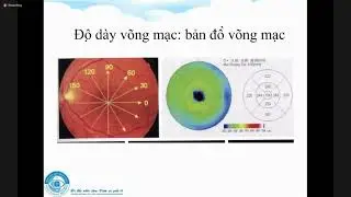 OCT VÀ CÁC BỆNH LÍ DỊCH KÍNH - VÕNG MẠC NGOẠI KHOA