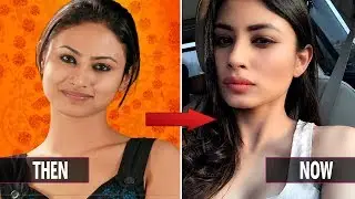10 Popular Tv Actresses Plastic Surgery Then - Now 2017