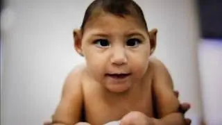Birth Defects,Human Monkeys,IVF/ICSI,Congenital heart defects in newborns,Autism
