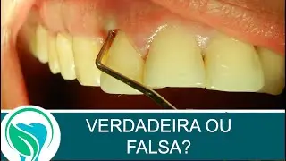 Compreenda os diferentes tipos de bolsas periodontais