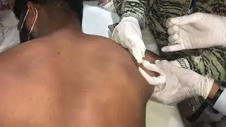 Dry Needling Course || Level 1 || CMT || OMTA || K Health Care || Dr Asif Khan || Dr Dileep Kumar||