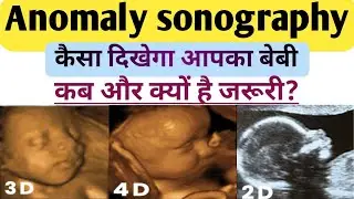 3D,4D Ultrasound Report/Anomaly Scan kya hota Hai#ColourDoppler ultrasound#pregnancy#ultrasound#baby
