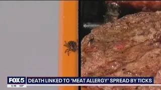 New Jersey man dies from rare meat allergy linked to tick bite