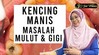 Dr Jue - Kencing Manis boleh menyebabkan masalah mulut dan gigi. Hati hati jika anda ada simptom ni!