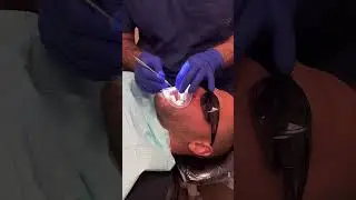 Teeth Whitening at Smile24Dentistry in Phoenix. Process, Before/After #hollywoodsmile #shorts