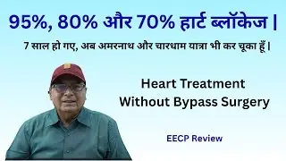 Heart Treatment without Bypass Surgery | EECP Treatment Review