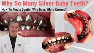 Why You See So Many Silver Crowns on Baby Teeth? How to Find a Dentist Who Does White Crowns?
