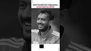 hair transplant cricket players | famous hair transplant celebrities | clioncare