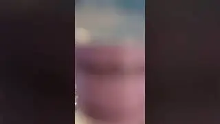 Размеры хирургических шприцев 💉