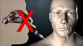 RAPID RHINO&loz; Epistaxis Products