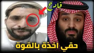 مواطن سعودي يتحدى محمد بن سلمان _ حقي يجيني بالطيب او بالقوة🔥