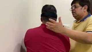 Left Apogeotropic Posterior Semicircular Canal BPPV