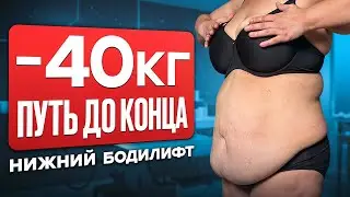 Это не показывают после похудения. Минус 40 кг: правда о теле после