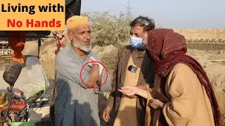 Story of passionate old man living with no hands | I lost my hands but never stopped hard work