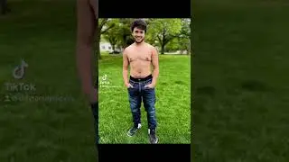 FTM Top Surgery (Double Incision)
