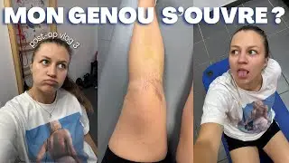 MON GENOU SE RÉOUVRE APRÈS L'OPÉRATION ?! | Post op vlog n°3 : agrafes, massage et grosse panique