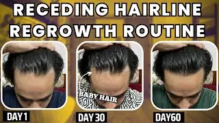 Hairline Regrowth Possible Hai | My Real Routine at 36 No Scam