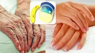 Fight ageing remove wrinkle hands, how to get a baby wrinkled face and soft hands