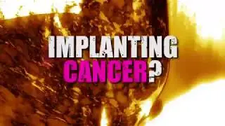 7 ON YOUR SIDE: Implant Cancer? :30