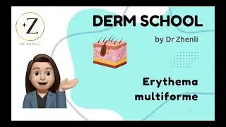 Derm School - Erythema multiforme