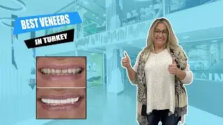 Why should you get FULL SET OF VENEERS in Turkey? | Myra Dental Centre Turkey 🦷