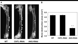 Bone destruction; loss of normal bone architecture due to pathological processes