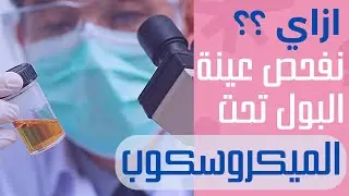 12_مراجعة علي تحليل البول الكامل عملي  والتدريب علي قراءة التقرير