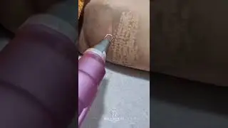 Eliminaci&oacute;n de Manchas en Axilas y Entrepiernas | Centro de Est&eacute;tica Jessica Barraza