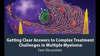 Getting Clear Answers to Complex Treatment Challlenges in Multiple Myeloma
