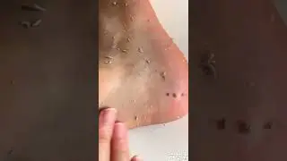 Instant Foot Peeling Spray Remove Dead Skin, Hydrate, and Nourish #viral #trending #shorts