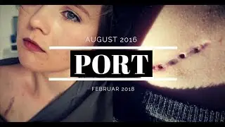 KREBS - PORT REIN - CHEMOTHERAPIE - THROMBOSE - PORT RAUS || Sandra Tyson