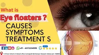 what is eye floaters?know more about causes, symptoms,treatments.#cataract #eyetreatment #eyesurgeon