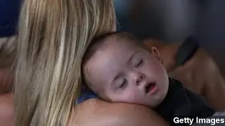 Risk Factors For SIDS Vary With Baby's Age